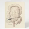 Cognitive Surplus Appendex Surgery Card - Science Stationery | * Greeting Cards | Medicine
